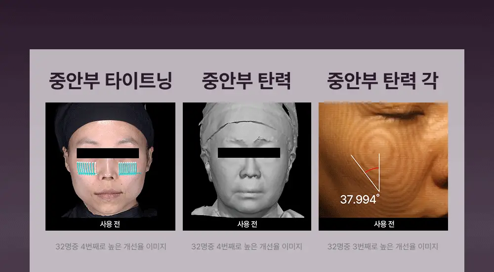 [고주파 멀티디바이스] LG 프라엘 써마샷 얼티밋 상세페이지 18